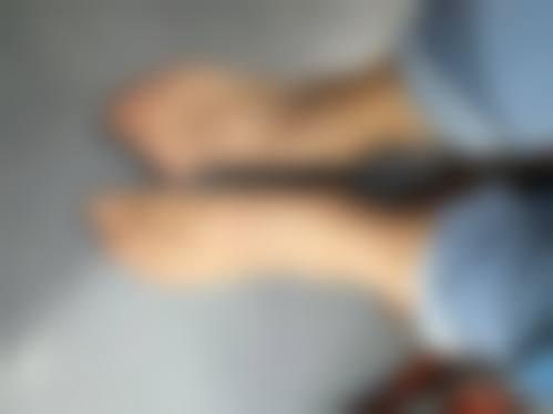 瘦脸针打了多久成效更明显