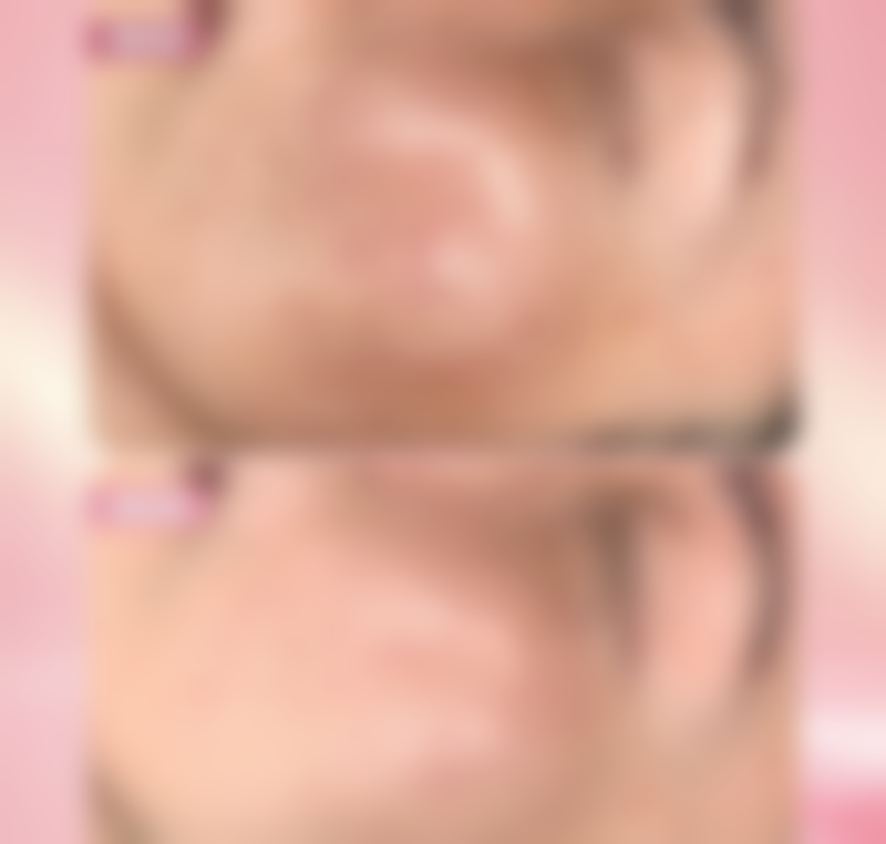 植发的相关知识和优势机构推荐