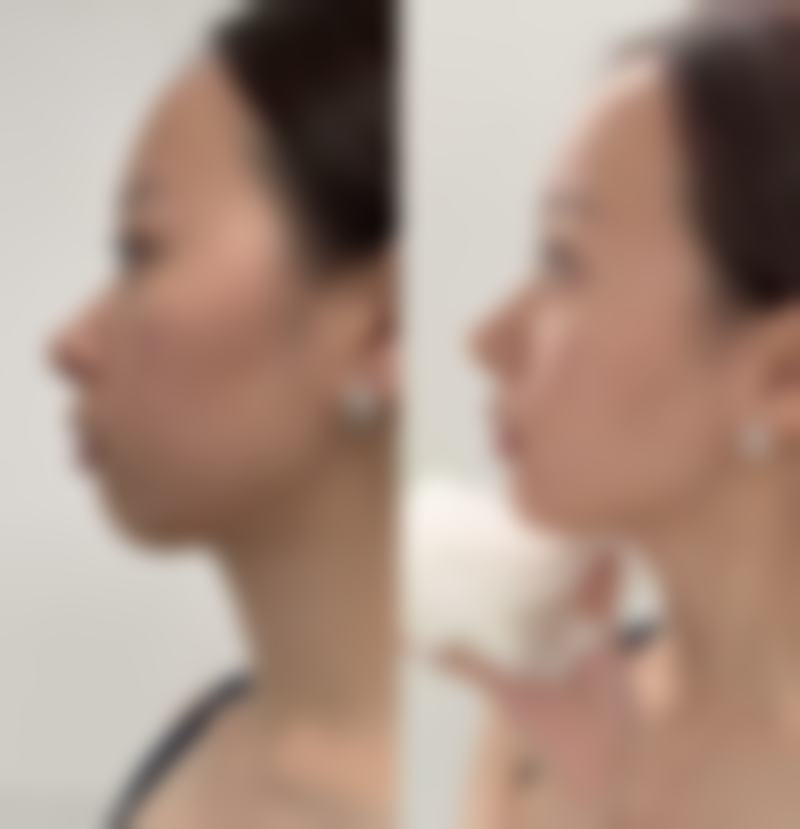 【厦门思明新生医疗美容门诊部怎么预约挂号?】