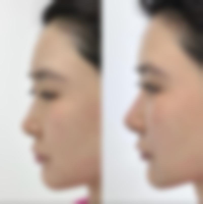 【上海丽保佳(保加)医疗美容门诊部怎么预约挂号?】