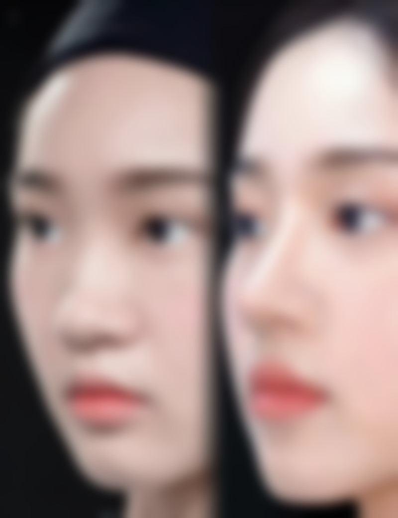 【湛江市霞山区美杜莎医疗美容特色项目：】