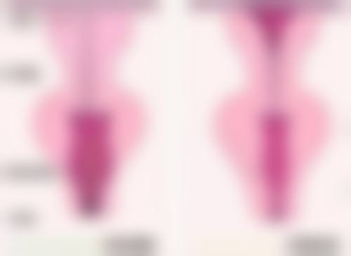 毛发种植后多久长出来