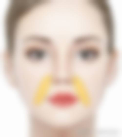 注射瘦脸针的副作用和危害