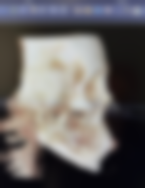 适合注射瘦脸针的人群