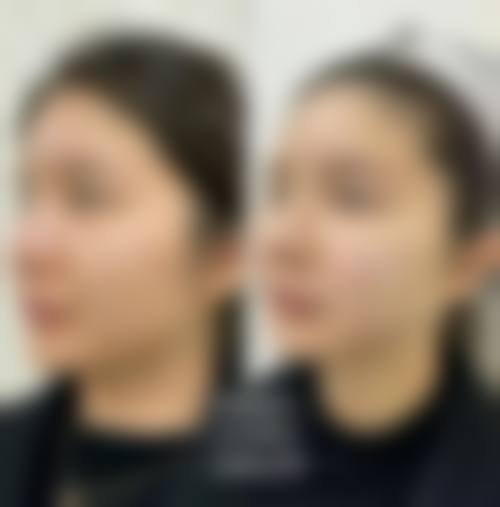 【万惠芳医生擅长项目】
