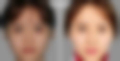 【徐德镇医生擅长项目】