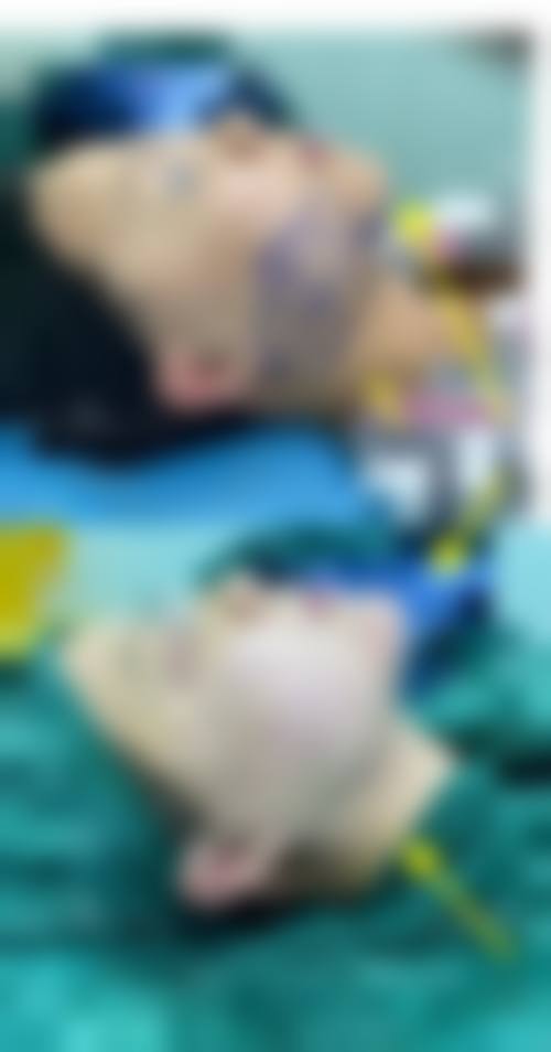 【徐德镇医生技术特点】