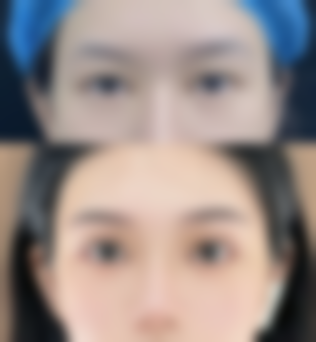 【韩国魔镜皮肤科整形外科参考价格表：】