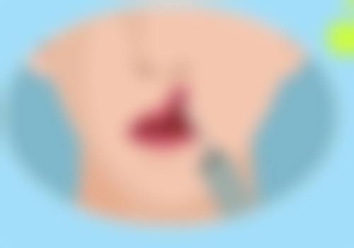 【广州奕华整形医院是正规的吗?】