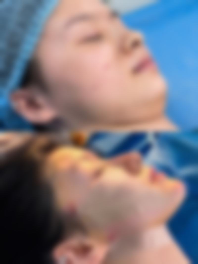 【广州奕华整形医院核心优势：】