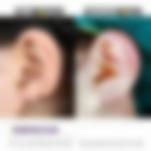 【汕头悦美荟医疗美容门诊部是正规的吗?】