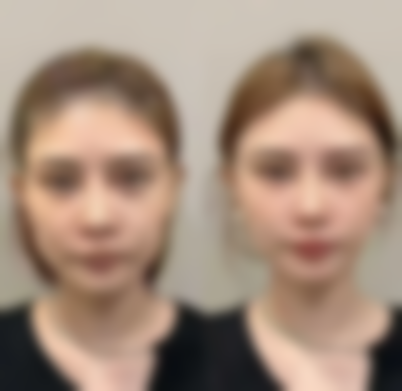 【揭阳张小红医疗美容诊所诊疗设备：】