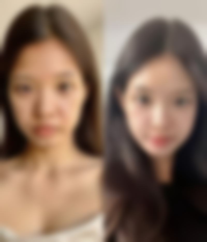 笑起来歪嘴如何调节