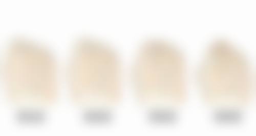 上嘴唇太厚怎么改善？揭秘3种医美方法，让你轻松拥有自然美唇，告别厚唇烦恼！ 