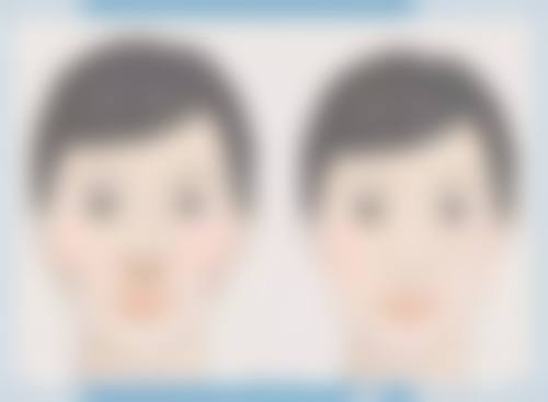 虞美人全脸除皱对身体不好吗
