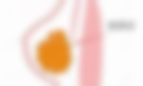上嘴唇黑怎么改善