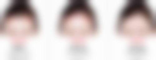 虞美人除皱能维持多久