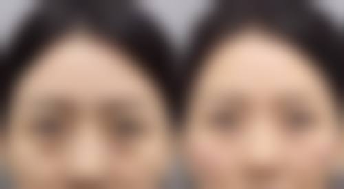 100ml0.9%生理盐水的配制