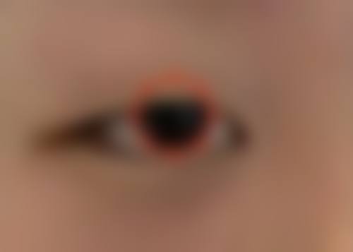头发越来越少吃中药能调理好吗