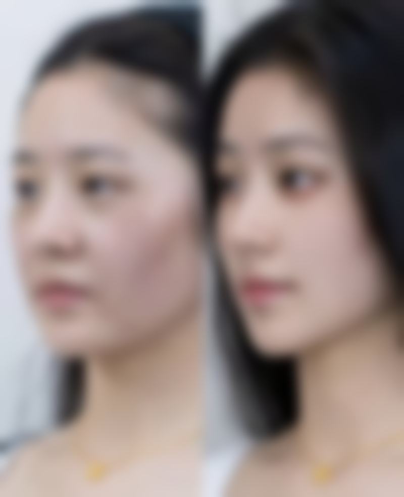 维生素能消除皱纹吗？揭秘4种关键维生素，助你轻松淡化皱纹，重焕肌肤年轻光彩！ 