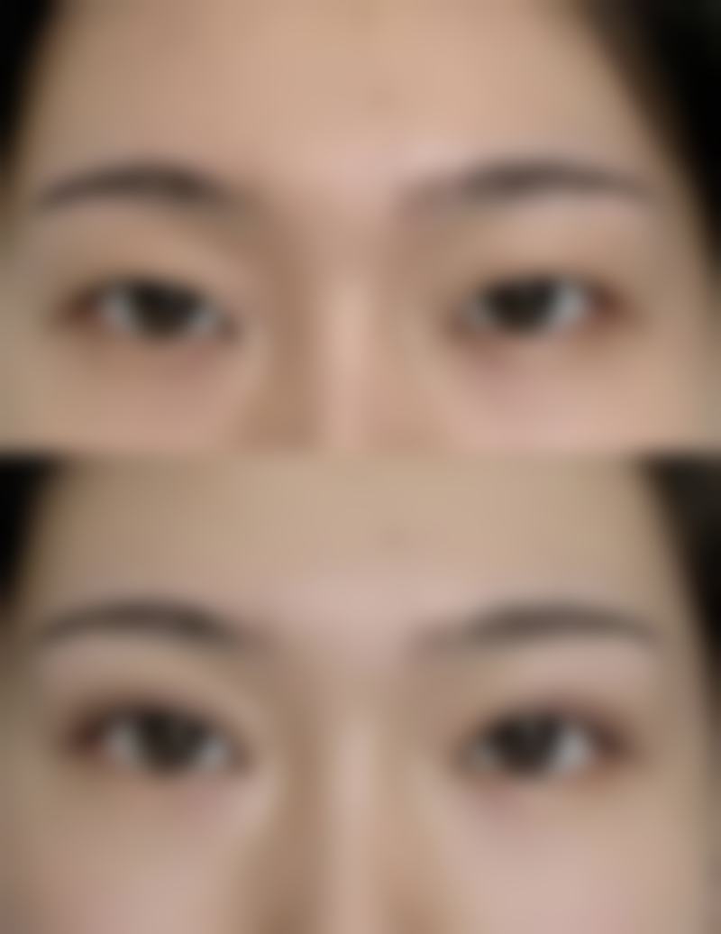 【运城海鸥医疗美容诊所特色项目：】