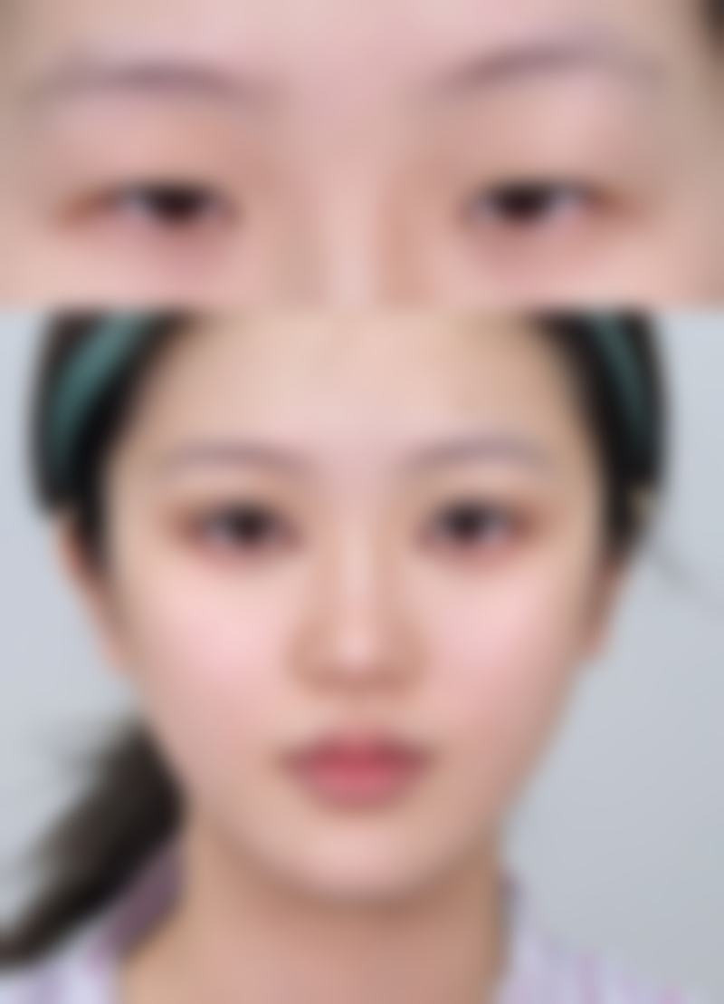嘴唇上翘而且厚的面相