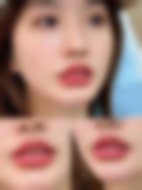 【深圳雅唯医疗美容门诊部特色项目：】