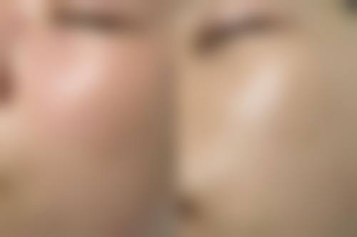 【临沂徐氏医疗美容诊所患者口碑评价：】