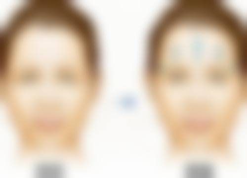 重庆铜雀台瘦脸针优势及价格情况