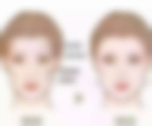 打完瘦脸针脸颊凹陷能修复到以前的样子吗