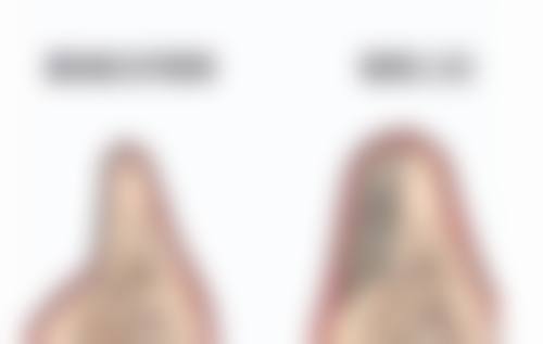 术前准备