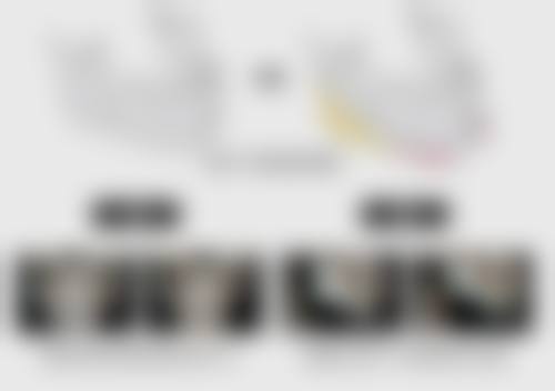 吃药能打瘦脸针吗？权威解析吃药与打瘦脸针的相互影响，5大要点助你安全变美！ 