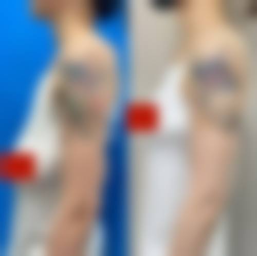 【聊城天使医联医疗美容参考价格表：】