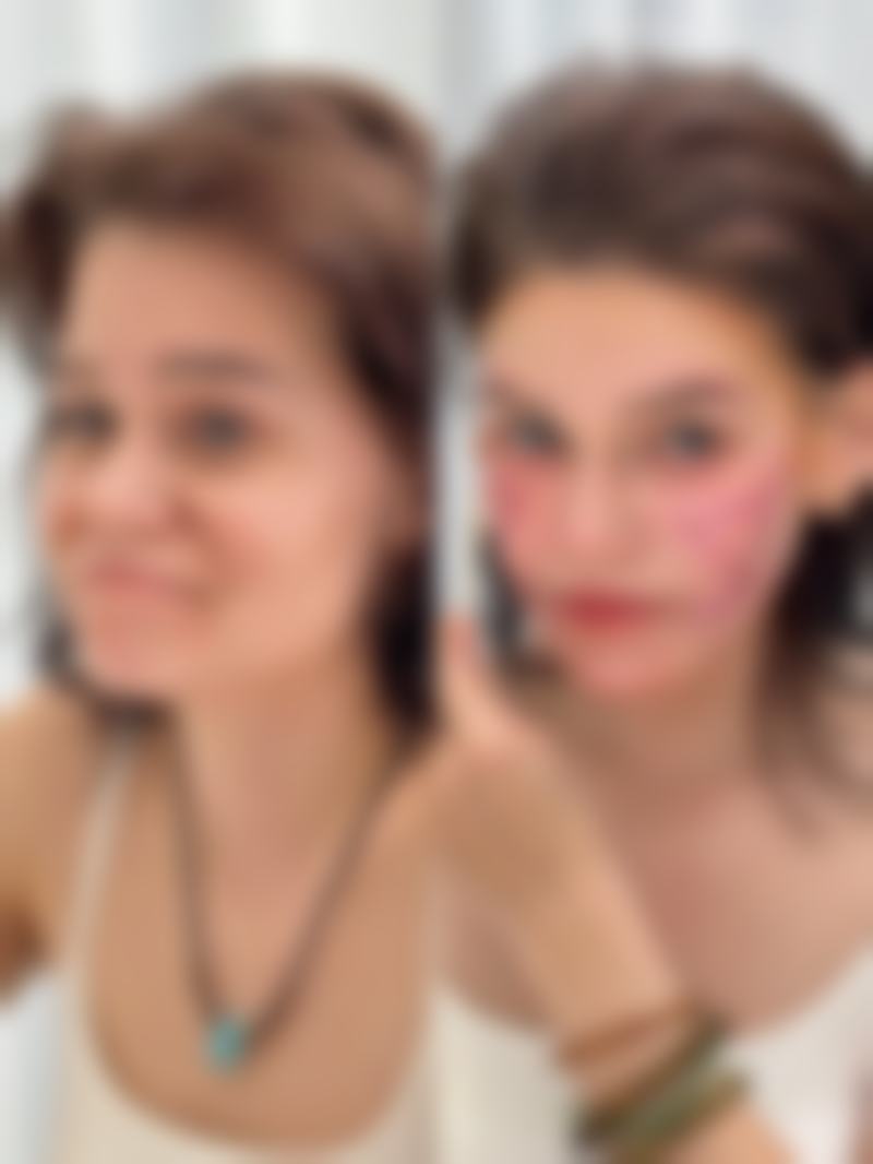 【武汉伊美馨医疗美容整形医院是正规的吗?】
