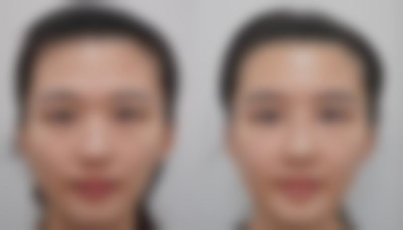常见疑问解答