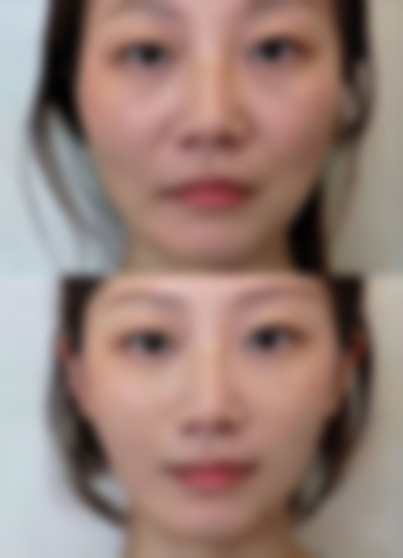 医院的各个科室之间协作非常紧密。从顾客预约开始,到术前的询问、检查,再到手术过程以及术后的护理,每个环节都有专精的人员负责。医生、护士、客服等人员之间相互配合,为顾客提供全方面的服务。