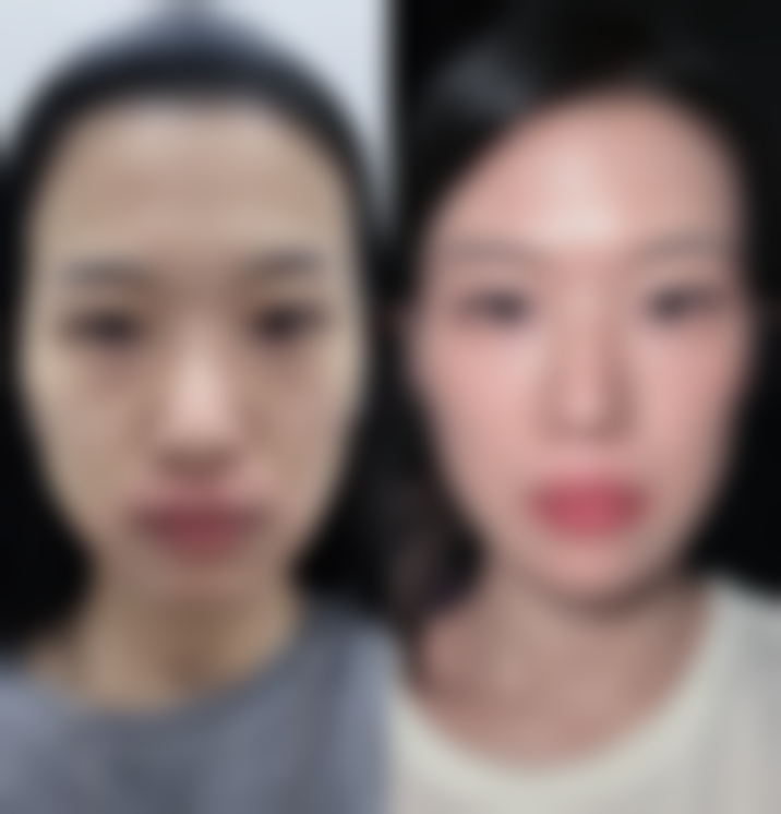 医院会在法定网站或者医院内部展示一些成功的实例。通过这些实例,顾客可以直观地看到医院的技术水平和治疗成效。同时,这些实例也能给顾客提供一些参考,让他们对自己的整形美容方案有更清晰的认识。