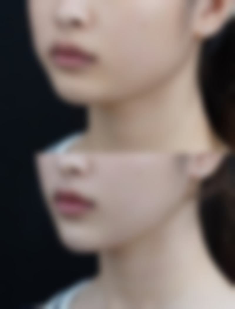 【聊城天使医联医疗美容地址：】