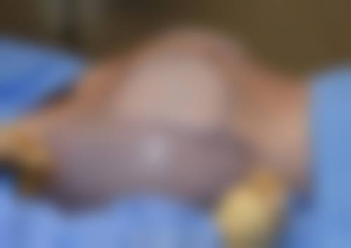 【刘生医生擅长项目】