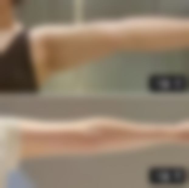 种植头发有什么危害？揭秘4大潜在风险及应对方法，让你安心享受医美植发的美丽蜕变！ 