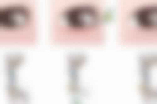 注射填充法的优点和不足