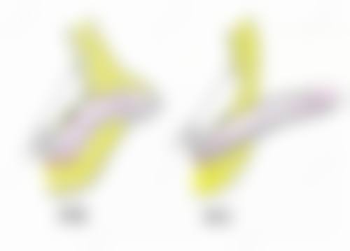 瘦脸针多久打二针？了解最佳间隔时间，助你轻松拥有精致小脸，塑造魅力颜值！ 