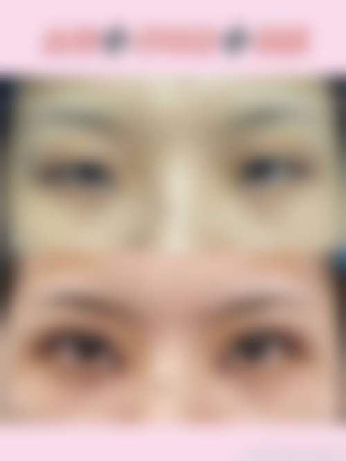 【内蒙古呼和浩特佳美医疗美容门诊部患者口碑评价:】