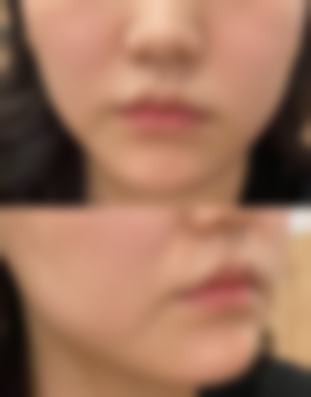 【陈双红医生技术特点】