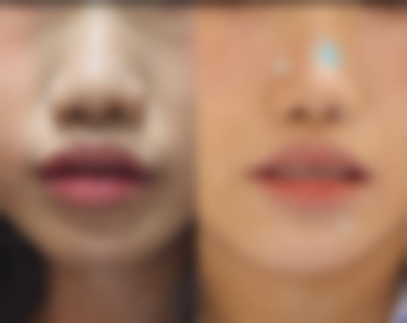 【苏州PPP整形医院患者口碑评价：】