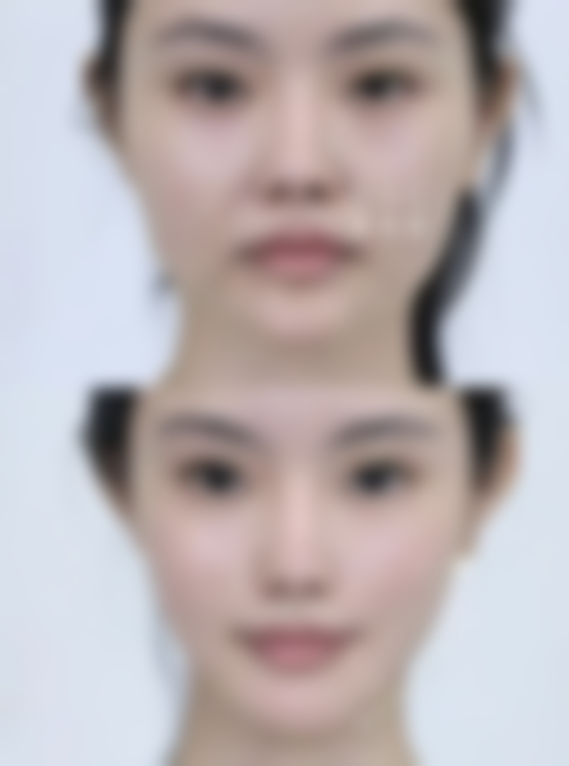打美白针不能吃什么？揭晓5类禁食食物，助你避开美白“雷区”，让美白效果更持久！ 