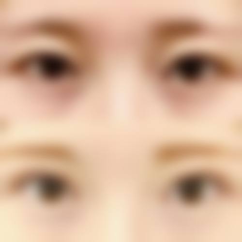 【陈小光医生擅长项目】