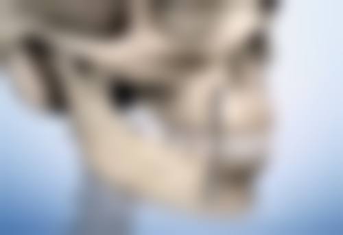 其他去除双下巴的方法