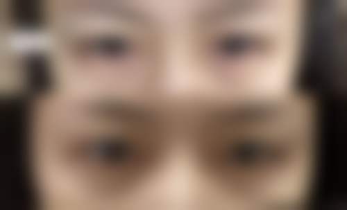 【郑州风信子医疗美容门诊部怎么预约挂号?】