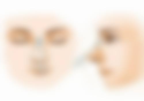 打完瘦脸针多久成效更明显